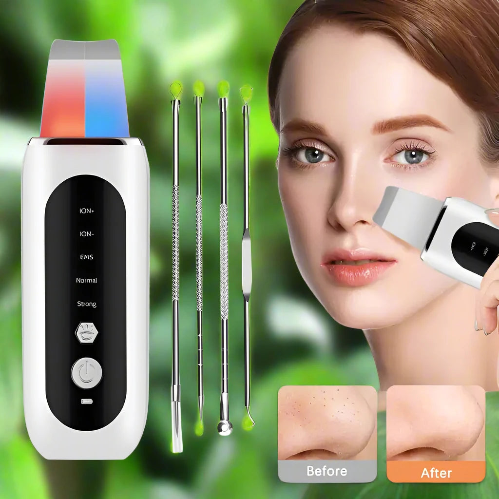 ZYFRA Ultrasonic Blackhead Remover™