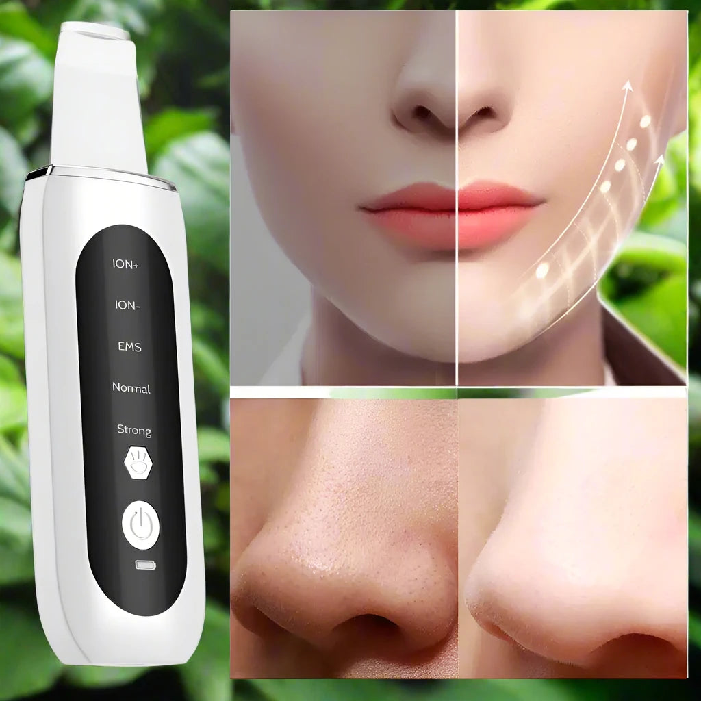 ZYFRA Ultrasonic Blackhead Remover™