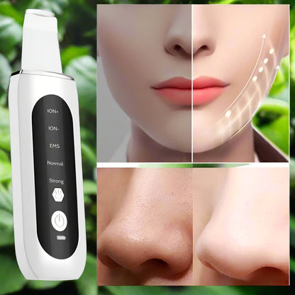 ZYFRA Ultrasonic Blackhead Remover™